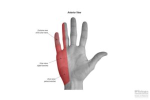 Cubital Tunnel Syndrome – Hand Therapy Group