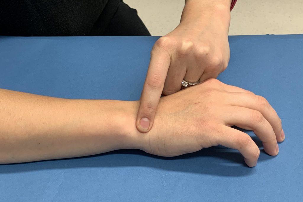 Ulnar Sided Wrist Pain – Hand Therapy Group