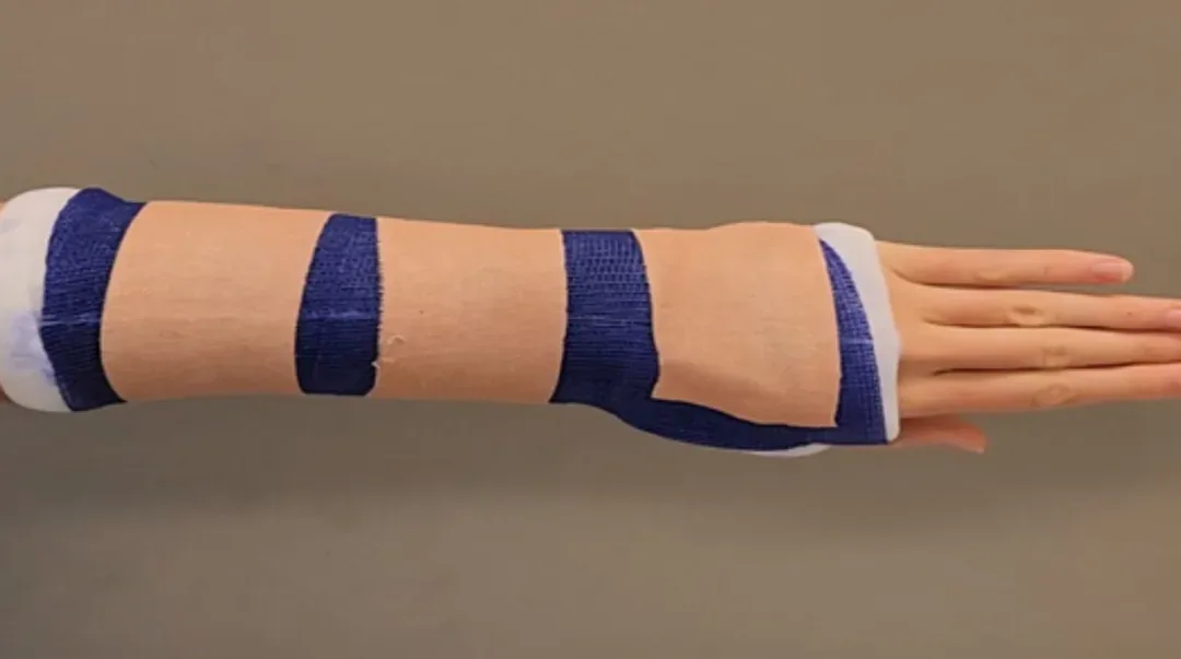 How to Fly with a Broken Arm