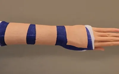 How to Fly with a Broken Arm