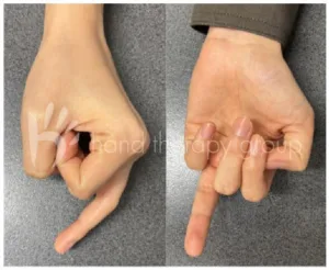 Have you heard of “Avocado Hand”?