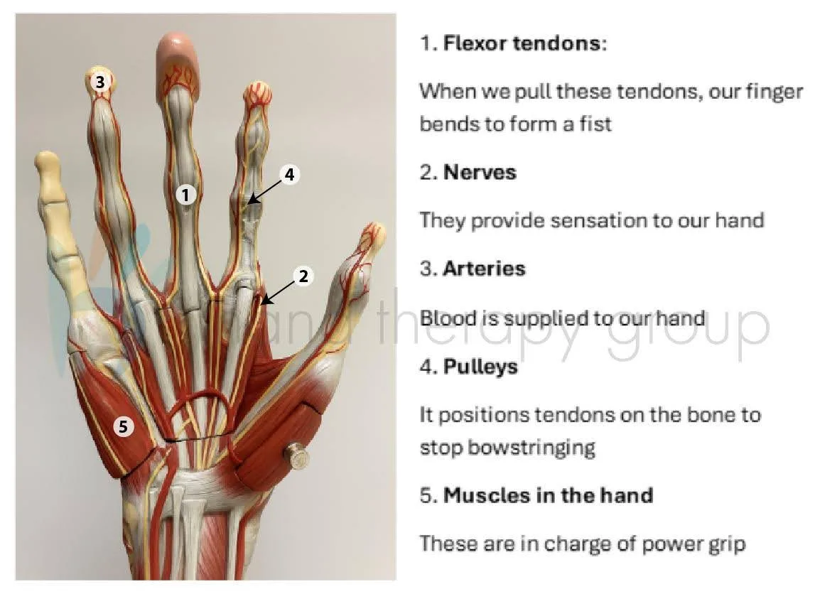 Have you heard of “Avocado Hand”? - Hand Therapy Group