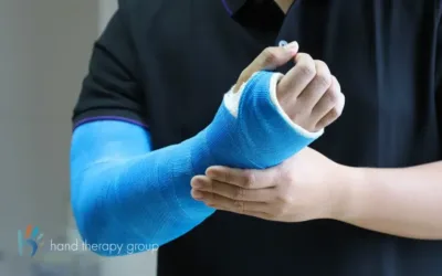 How Casts Are Removed
