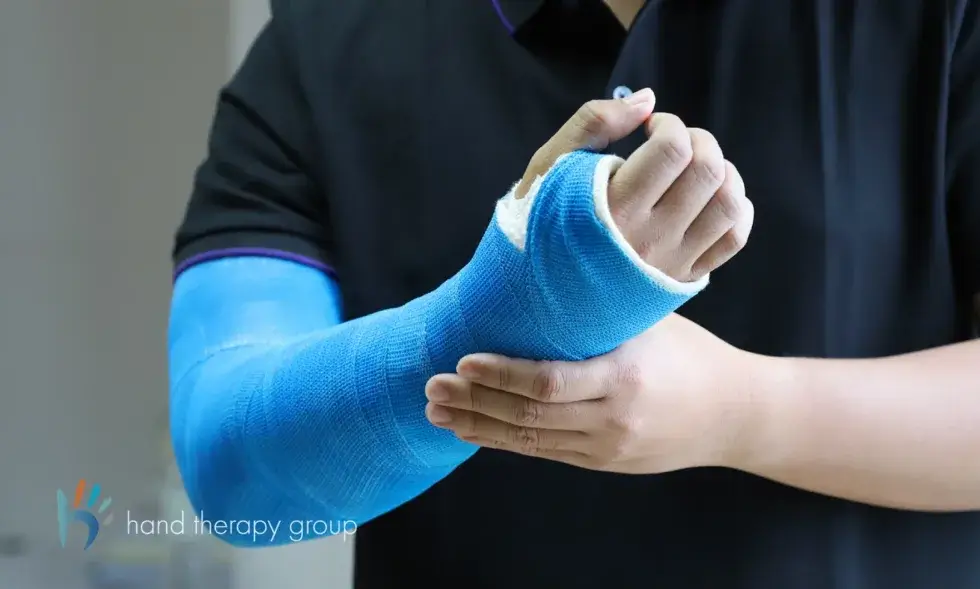 How Casts Are Removed